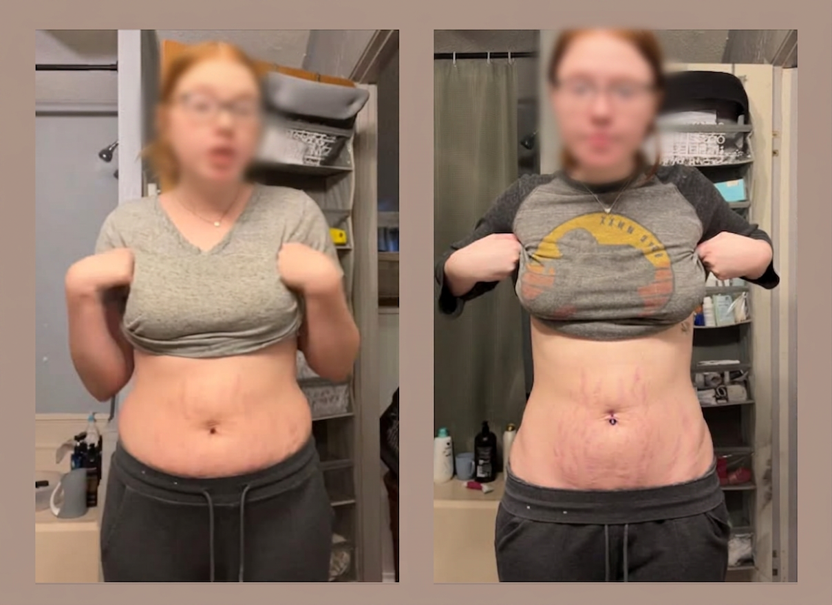 Transformation avant / après — de 178 lbs à 137 lbs en 4 mois post-partum